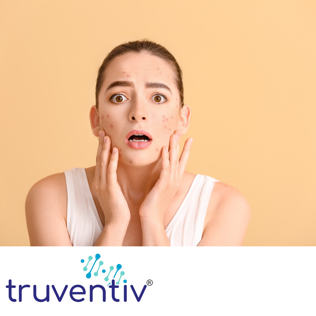 REDUCES REDNESS & BLEMISHES